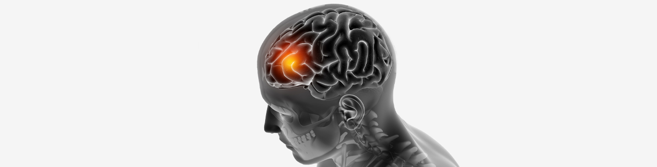 Stroke rehabilitation: Make your journey easy with these tips