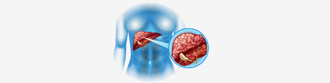 From abdominal pain to loss of appetite: Here are some symptoms that could be linked to Gallbladder Cancer